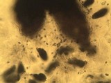Sclerococcum sphaerale image