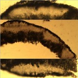 Arthonia radiata image