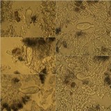 Arthonia radiata image