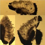 Opegrapha mougeotii image