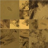 Opegrapha mougeotii image