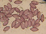 Ascobolus hansenii image