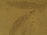 Leptogium lichenoides image