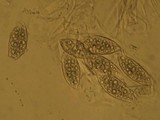 Leptogium lichenoides image