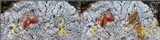 Pertusaria lactea image