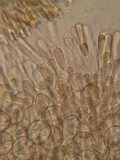 Pachyella babingtonii image