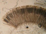 Pachyella babingtonii image