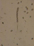 Pachyella babingtonii image