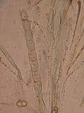 Pachyella babingtonii image