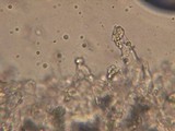 Melanoleuca strictipes image