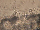 Melanoleuca strictipes image