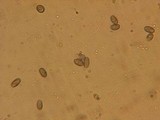 Melanoleuca strictipes image