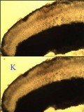 Lecanora albella image
