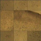 Lecanora albella image