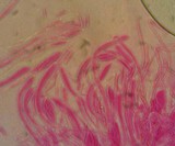 Mitrula elegans image