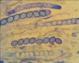 Scutellinia umbrorum image