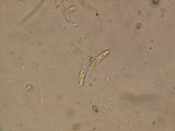 Chaetosphaeria ovoidea image
