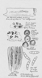 Chaetosphaeria ovoidea image