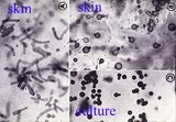 Malassezia furfur image
