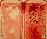 Paracoccidioides brasiliensis image