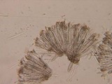 Coccomyces arbutifolius image