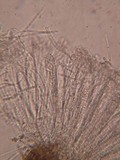 Coccomyces arbutifolius image
