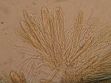 Coccomyces arbutifolius image
