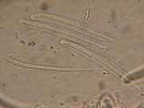 Coccomyces arbutifolius image