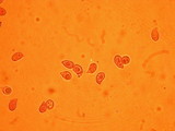 Rhodocollybia maculata image