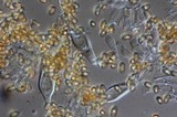 Inocybe whitei image