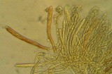 Pezizella alniella image