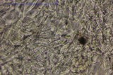 Lachnum abnormis image