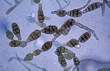 Alternaria alternata image