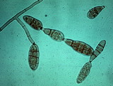 Alternaria alternata image
