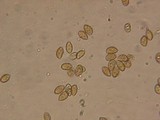 Galerina tibiicystis image