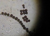 Scleroderma cepa image