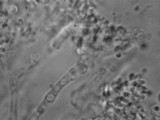 Campanella vinosolivida image