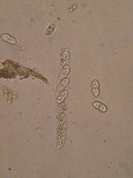 Sydowiella fenestrans image