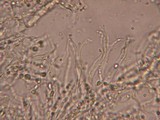 Dacrymyces minor image