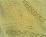 Scutellinia umbrorum image