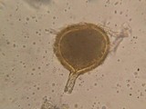Rhizophagus fasciculatus image