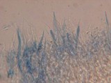 Phanerochaete calotricha image