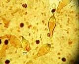 Panaeolus bisporus image