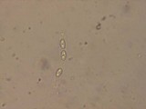 Natantiella ligneola image