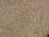 Natantiella ligneola image