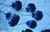 Aspergillus fumigatus image