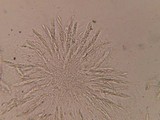 Chaetosphaeria ovoidea image