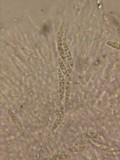 Chaetosphaeria ovoidea image