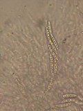 Chaetosphaeria ovoidea image