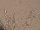 Chaetosphaeria ovoidea image